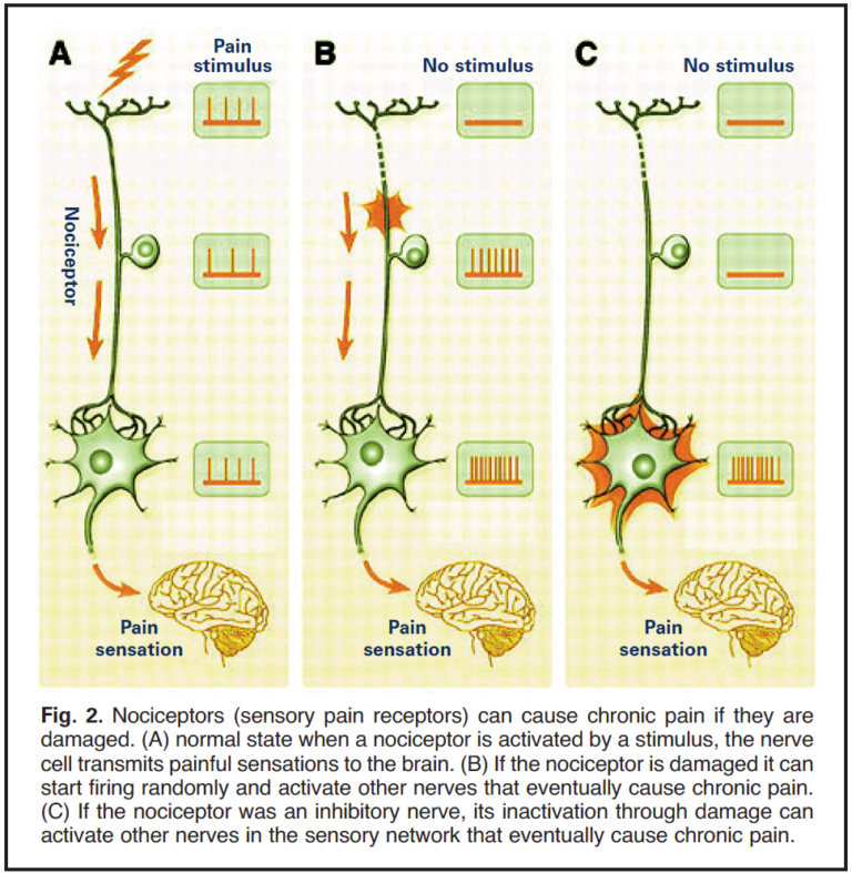 Traditional Chinese Herbs for Arthritis Nutrition Review