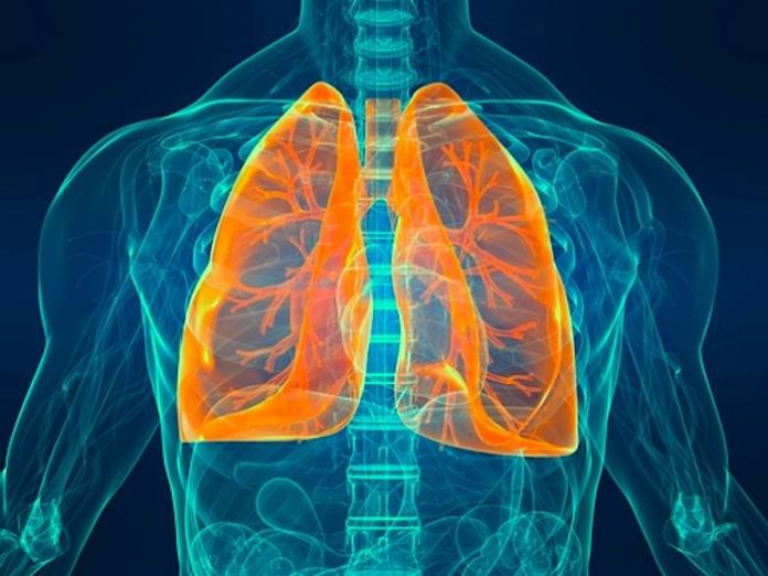 Reversing Inflammation In Old Lungs Restores Youthful Immune Response 