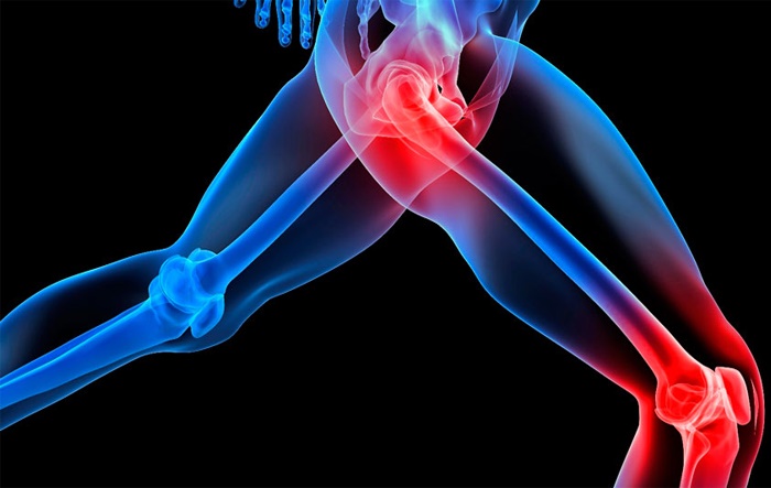 foods-to-avoid-if-you-have-joint-pain