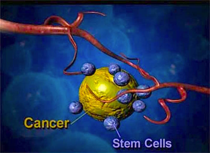 Cancer Stem cell