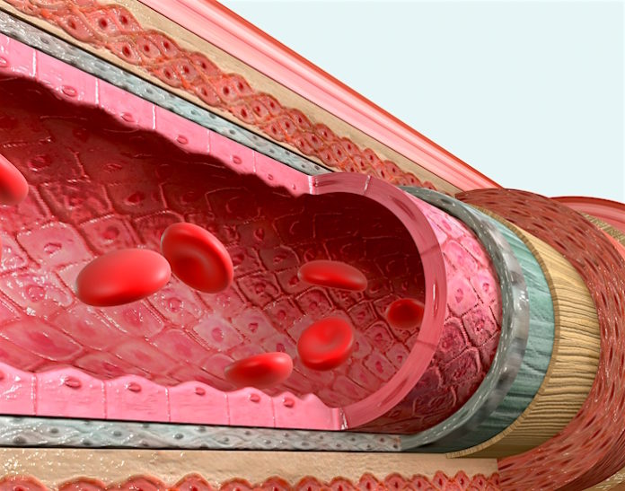 how-elevated-blood-sugar-levels-damage-blood-vessels-to-trigger